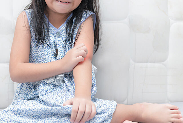痒みで腕を掻く女の子